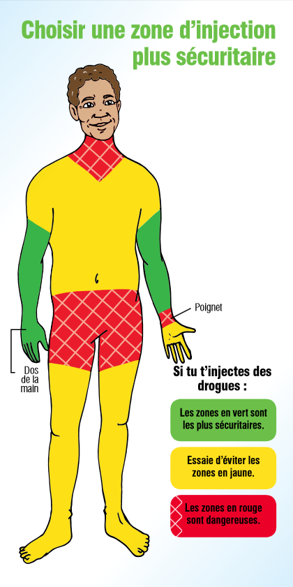 La varicosité lancé le traitement avec les moyens nationaux
