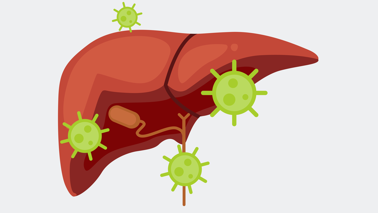 L'hépatite C contre le système immunitaire : La biologie de la ...