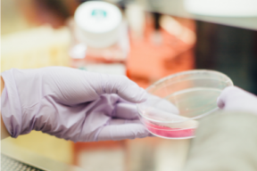petri dish