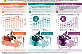 Chlamydia, gonorrhée et syphilis infectieuse au Canada : Données de surveillance de 2021
