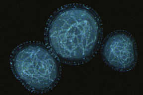 Mpox webinar scrape image