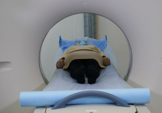 Large U.S. study explores risk of cancers in people with HIV